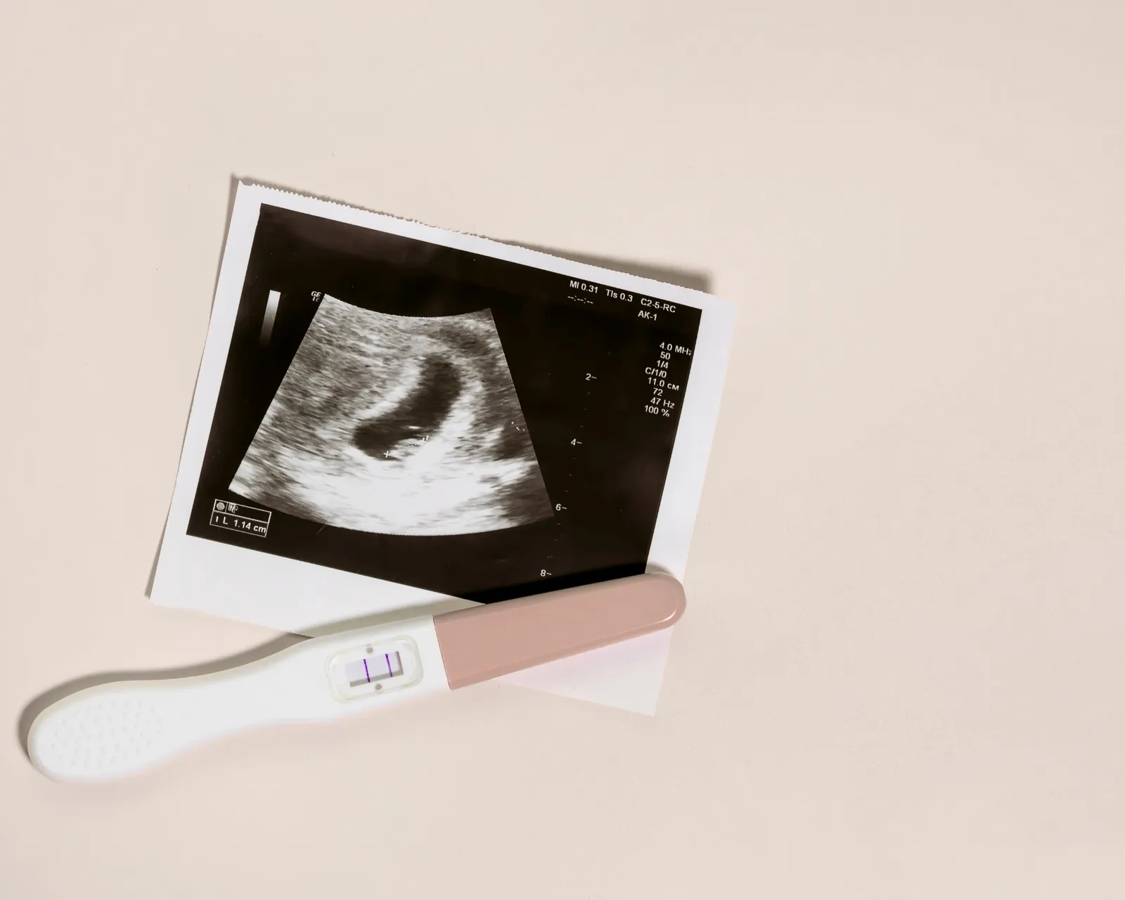 Kinderwunschbegleitung